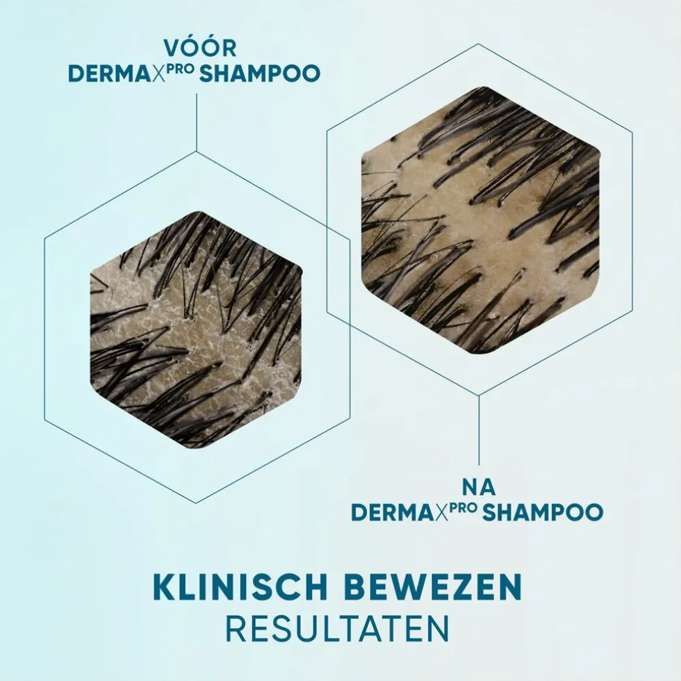 DermaXPro by Head & Shoulders Revitaliseert Antiroosshampoo