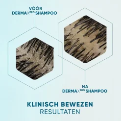 DermaXPro by Head & Shoulders Hydrateert Antiroosshampoo