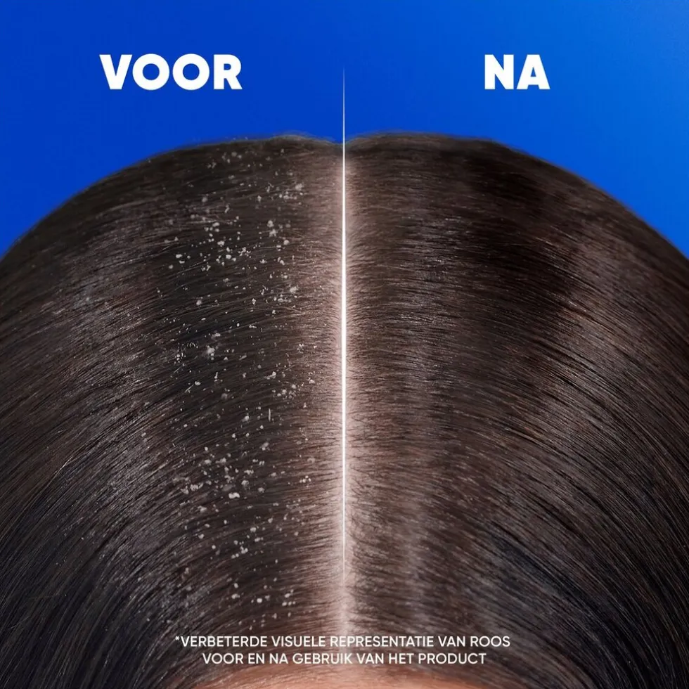 Head & Shoulders Classic Antiroosshampoo