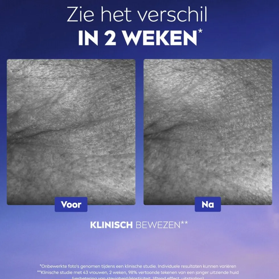 NIVEA Cellular Epigenetics Ultiem Huidverjongend Serum