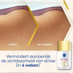 NIVEA Luminous630 Anti-Striae/Anti-Striemen Body Oil-Serum