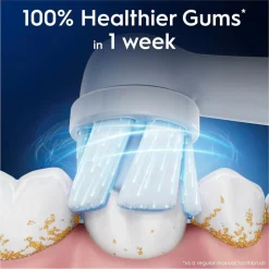 Oral-B iO Gentle Care Opzetborstels